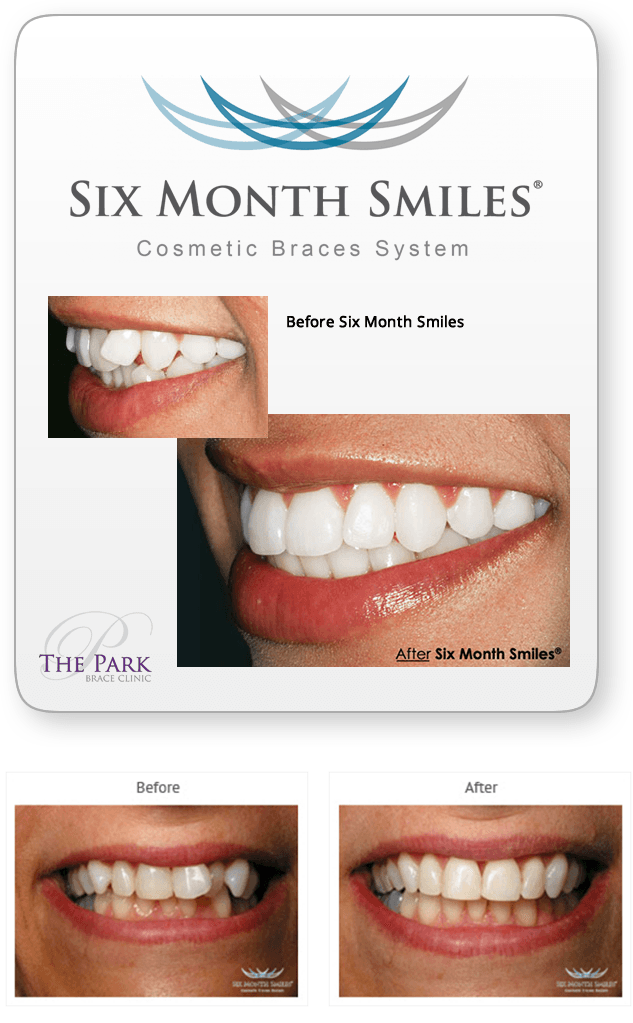 6 month smile cost caresource insurance cognizant appraisal rating 2018